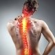 kriva hrbtenica - skolioza