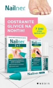 PR – Glivic na nohtih se ne boste znebili v 20-ih sekundah! – Medis