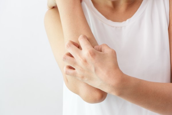 Individualni pristop zdravljenja atopijskega dermatitisa
