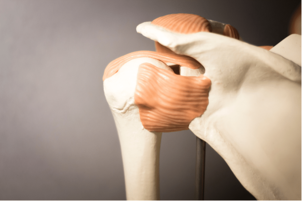 Zakaj nastane kalcinacija sklepov in kako jo zdravimo?
