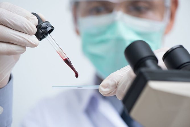 Krvna slika: ključne vrednosti, ki razkrivajo vaše zdravstveno stanje