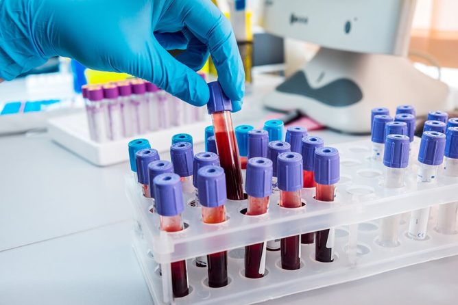 Nujna stanja v hematologiji