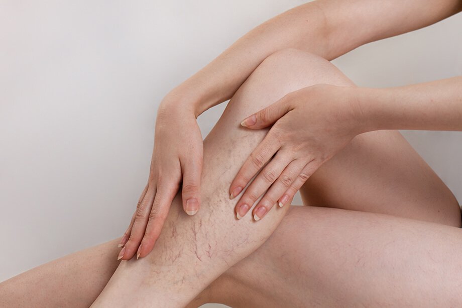 Sedenje s prekrižanimi nogami