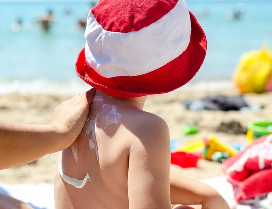 Sončne opekline so izjemno nevarne