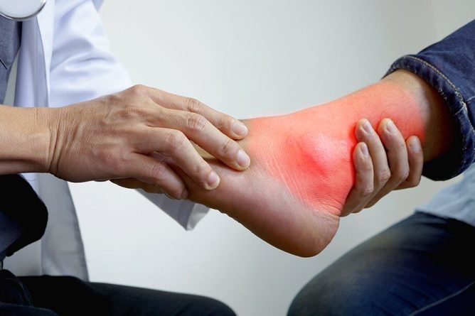 Športna okvara je bolezensko stanje