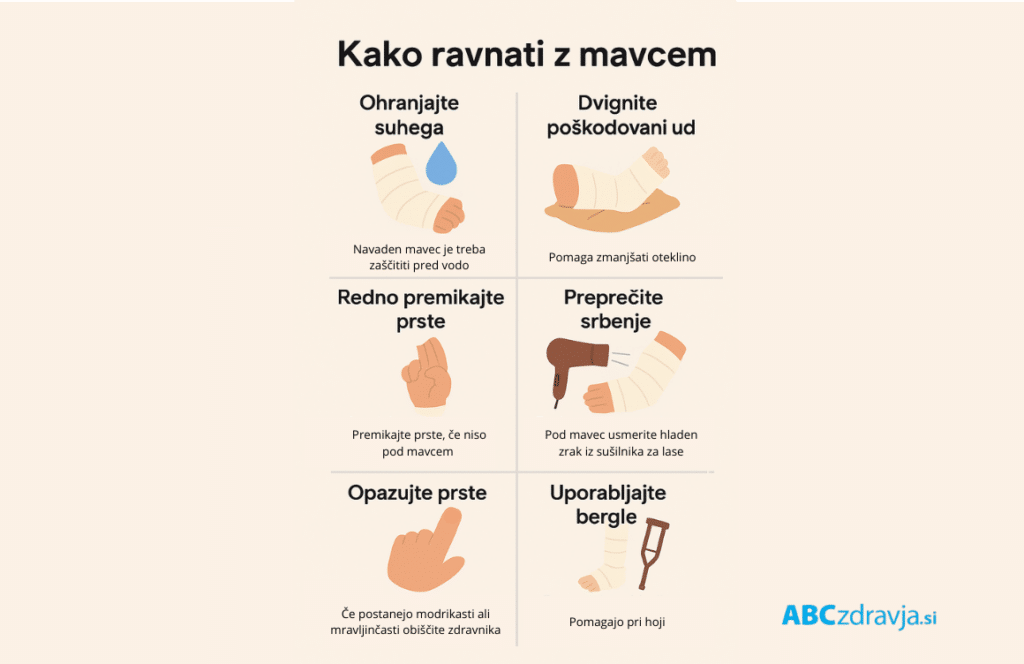 Infografika z naslovom "Kako ravnati z mavcem" prikazuje ključne nasvete za nego mavčne opornice: dvignjen ud, zaščita pred vodo, gibanje prstov, hlajenje srbečice s sušilnikom za lase ter opozorila, kdaj je nujen obisk zdravnika.