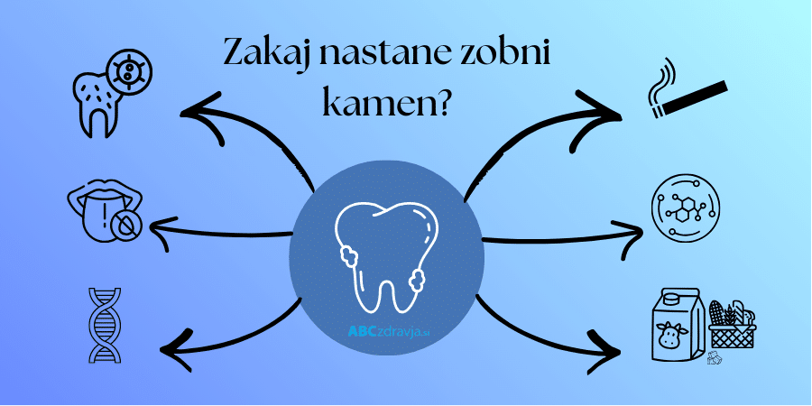 čiščenje zobnega kamna, zakaj nastane zobni kamen, zakaj nastaja zobni kamen, zobni kamen