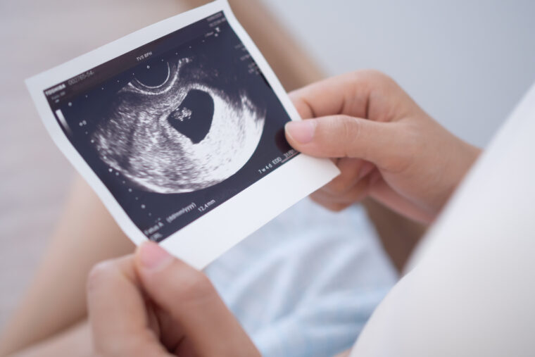 Pozno starševstvo: med svobodno izbiro, družbenimi pritiski in biološkimi mejami