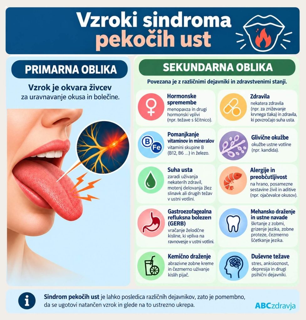 Infografika vzrokov sindroma pekočih ust: primarna oblika zaradi motenj živčnega delovanja ter sekundarna oblika zaradi hormonskih sprememb, pomanjkanja vitaminov, zdravil, suhih ust, glivičnih okužb, alergij, refluksa in drugih dejavnikov.